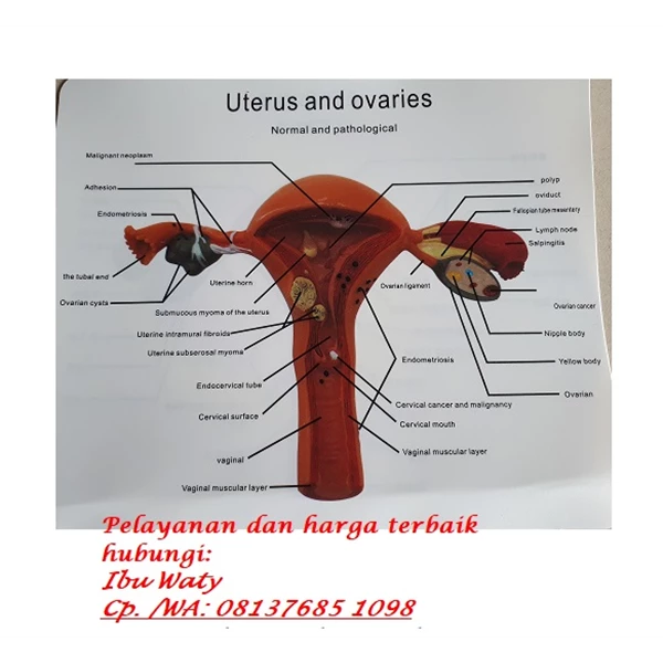 Uterine Anatomy Model Educational Teaching Aid
