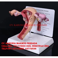 Alat Peraga Model Anatomi Human Female Uterus Ovary Disease - Alat Peraga Pendidikan